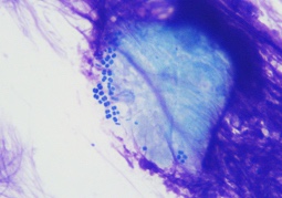 MicroscopyfromCanineSkin.png