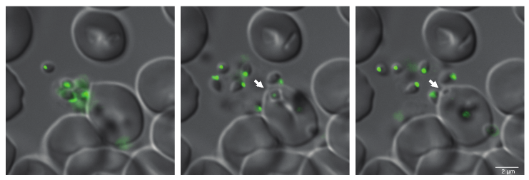Figure of GFP-expressing Plasmodium parasites invading human erythrocytes, a process which takes only seconds.