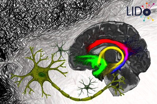 Investigating the cellular mechanisms of impaired neurodevelopment following early life exposure to air pollution