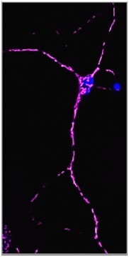 Neuron: mitochondria (power house of the cell) labelled with TMRM (purple) with the nucleus appearing in blue