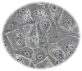 In vitro infection of Eimeria tenella sporozoites