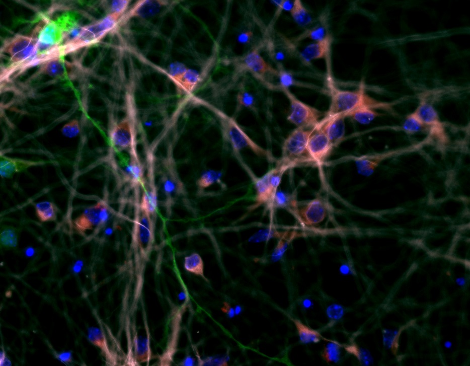 Cortical neurons in culture.