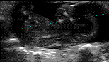 ultrasound scan of guinea pig foetus