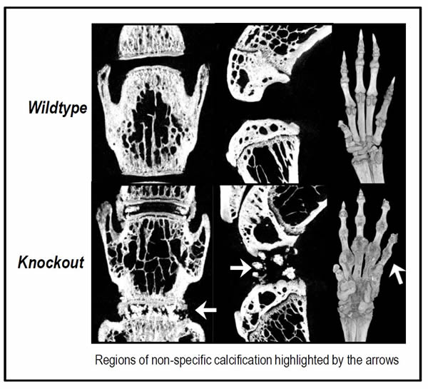 radiographs of normal and knockout mice skeletons showing regions of calcification