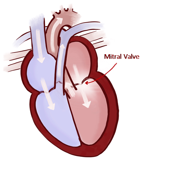 diagram showing positon of the mitral valve in the heart