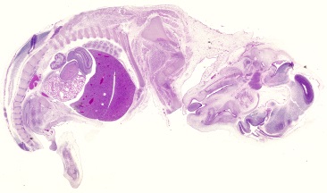 H and E section through a day 46 fetus showing the early development of the major organs