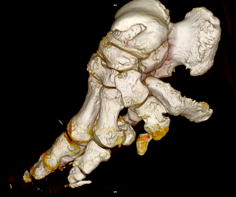 CT scan of an elephant's foot