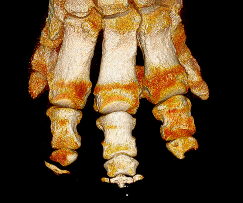 CT scan of an elephant's foot