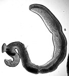 Schistosoma mansoni flatworm
