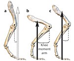 Three diagrams depicting the same leg bent to different degrees and the knee-moment arm when the leg is in each position 