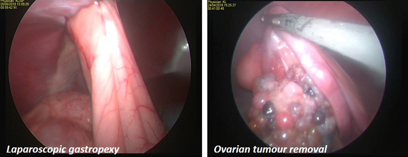 keyhole camera images of laparoscopic gastropexy and ovarian tumour removal