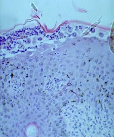 C:\Sonya's RVC Work\Derm cases\images\6_Welsh pony_Jan94\IMG0010_300H.jpg