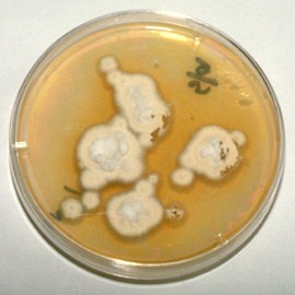 C:\Sonya's RVC Work\Derm cases\images\7_Jack Russell March 94\IMG0049_300x300.jpg