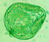 Moniezia egg