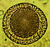 Toxocara vitulorum egg